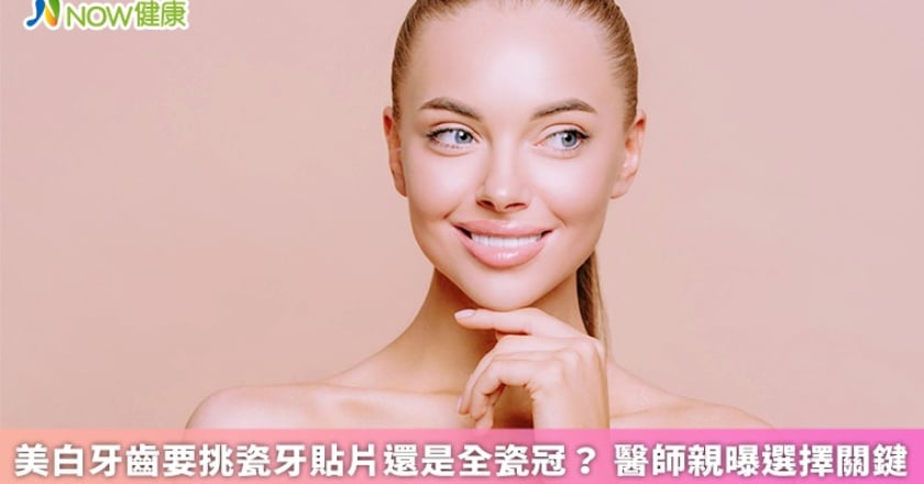 美白牙齒要挑瓷牙貼片還是全瓷冠？ 醫師親曝選擇關鍵