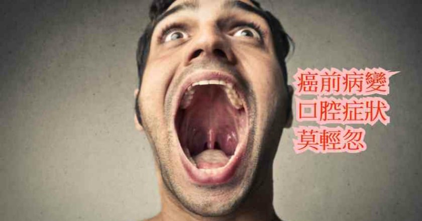 趕緊張開嘴檢查　出現這5症狀恐罹癌了！