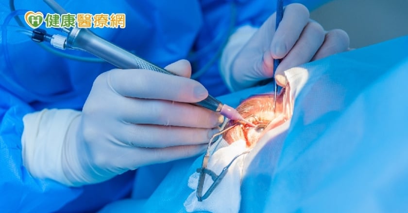逾千人等待眼角膜移植 「電紡紗」人工角膜可促進神經再生