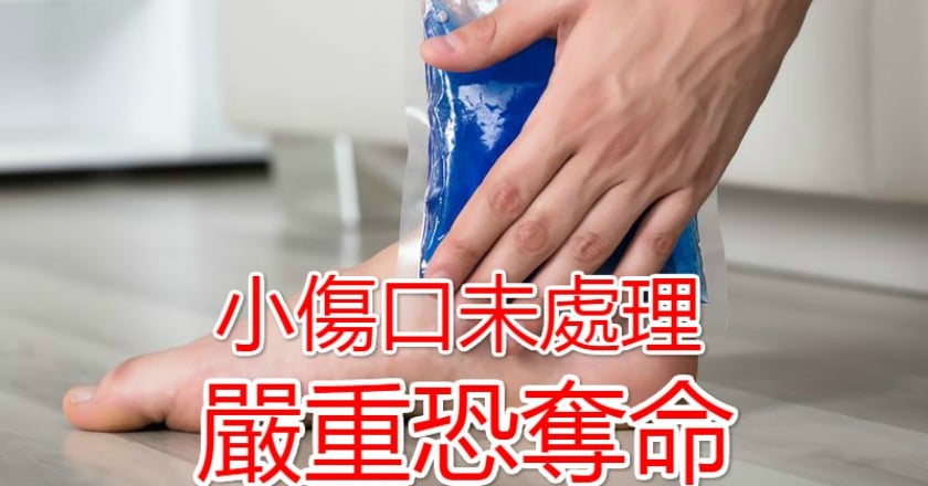 小傷口未處理　嚴重恐奪命