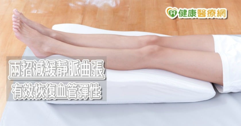 3大錯誤迷思當心惡化靜脈曲張 多做2件事助恢復血管彈性
