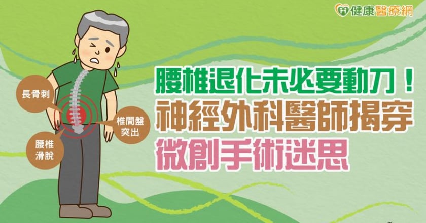 腰椎退化未必要動刀！神經外科醫師揭穿微創手術迷思