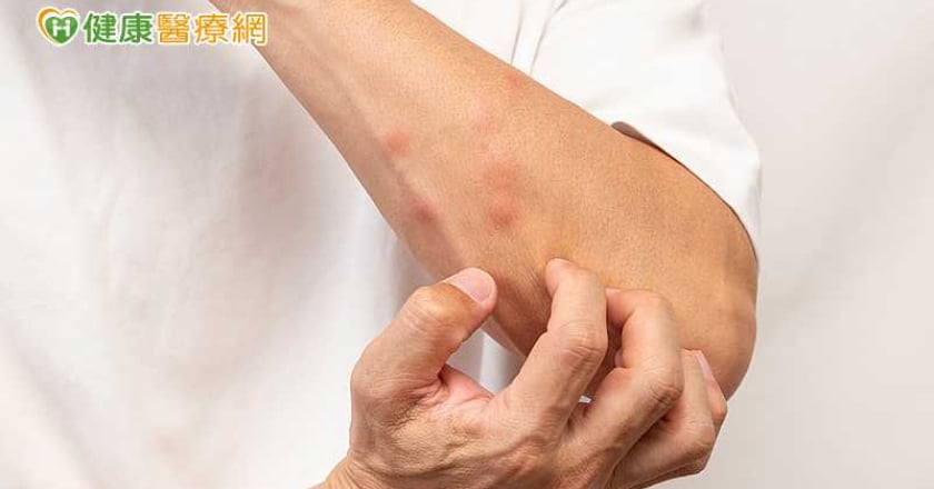 換季皮膚乾癢怎麼辦?醫揭常見原因 保濕、洗澡習慣是關鍵
