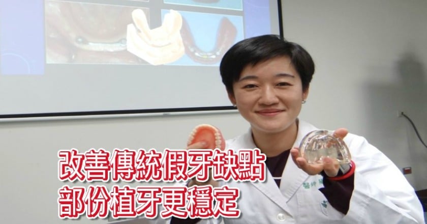 長者活動假牙變穩固! 醫:植牙支撐不再鬆動