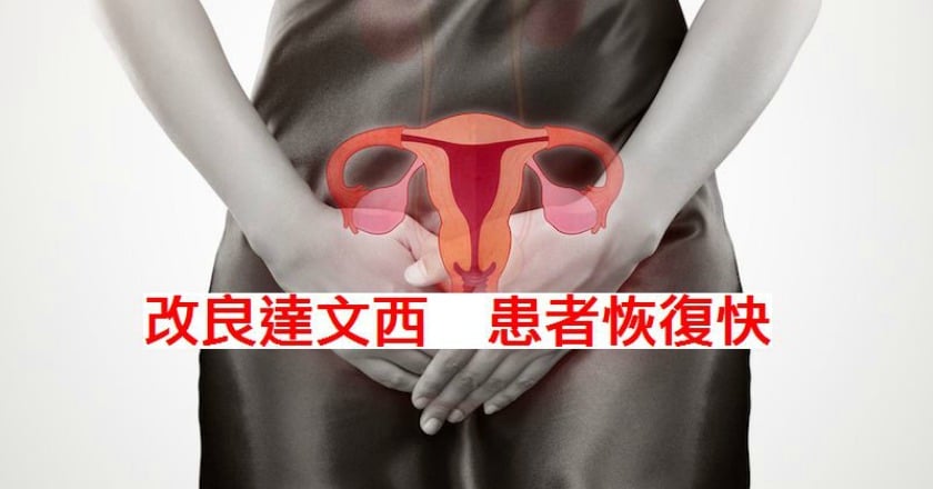 改良微創手術缺點　婦科治療新選擇