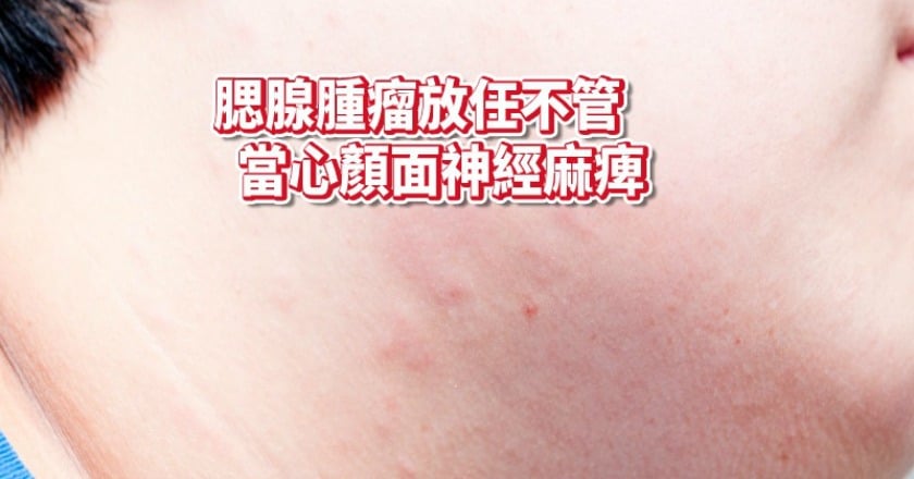 成人也會有「豬頭皮」! 男耳下腫脹逾四周...是警訊