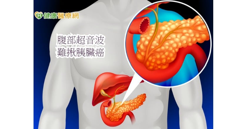 驗腫瘤指數 難擒癌王