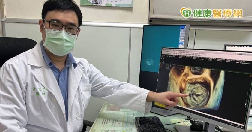 心臟超音波換一家做結果差很大? 3D立體影像弭平不安