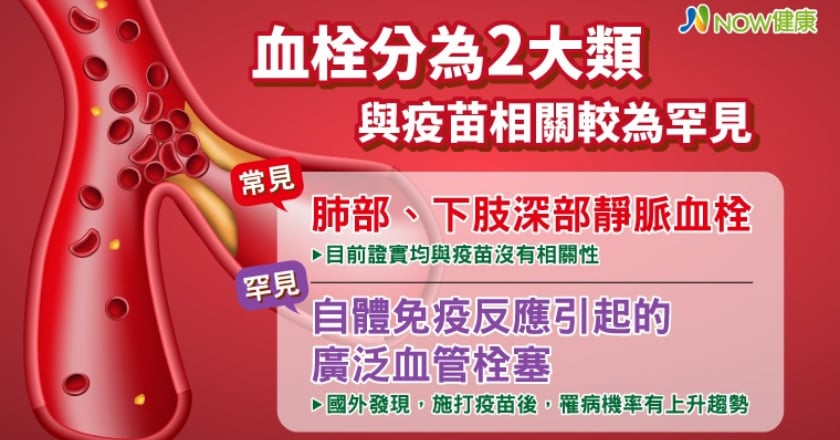 擔心血栓問題長輩不敢打AZ？ 這類血栓才與疫苗有關