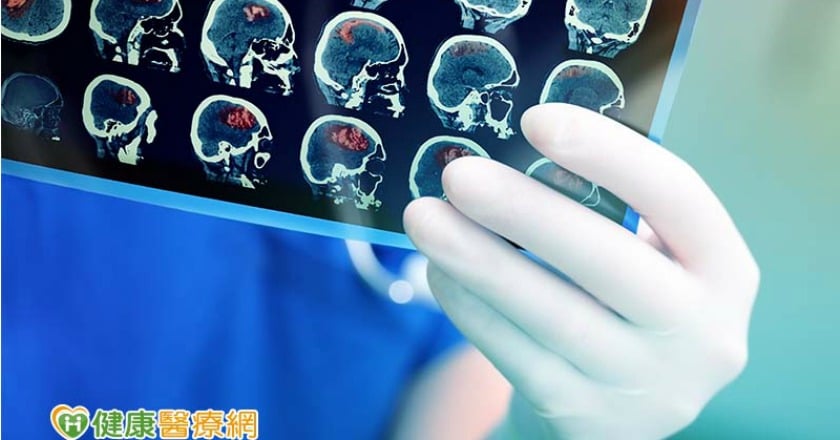 腦瘤免開腦！？　加馬刀手術破壞腫瘤DNA