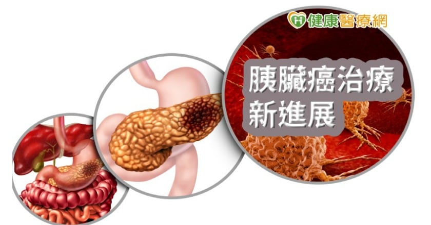 抗癌王新希望　新物質殺死90%胰臟癌細胞