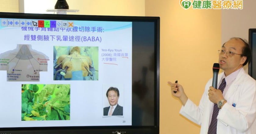 經口腔切除甲狀腺　3D安全裝置避損傷