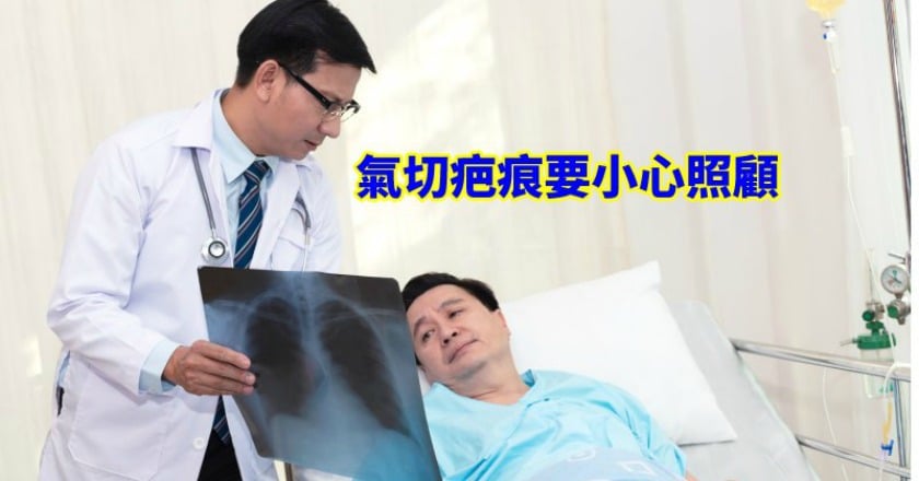 肺炎發出異常哮鳴聲 原來被「這個」堵住了