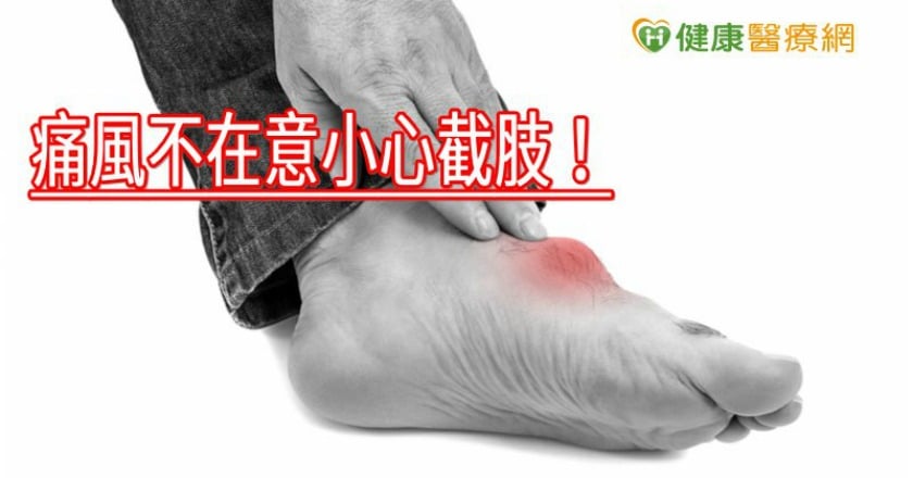 痛風不在意小心截肢！　新型微創手術復原快、傷口比一元硬幣還小