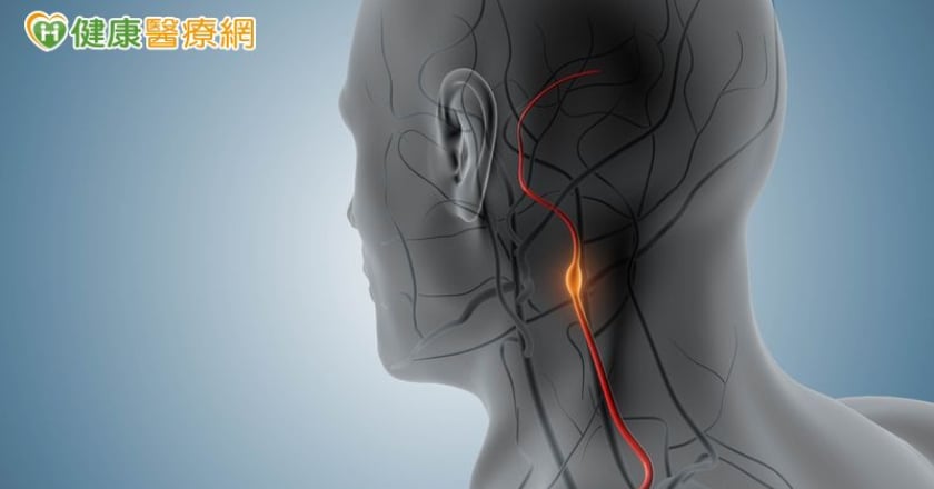 常頭暈又單側手腳發麻！醫警示：頸動脈狹窄恐釀中風風險