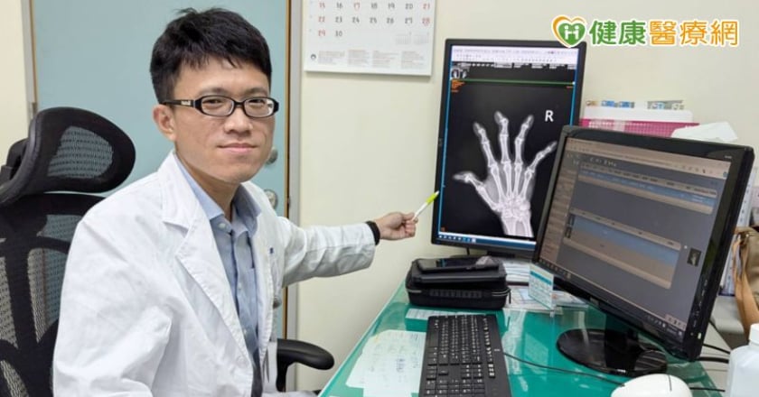 類風濕性關節炎別亂「補」！醫破迷思：這3種營養素要吃夠