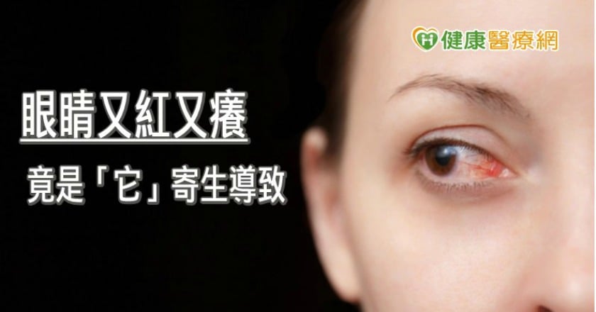 50歲婦眼睛又紅又癢　竟是蠕形蟎蟲寄生導致