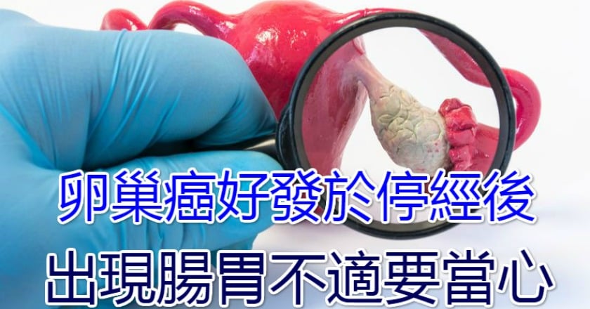 卵巢癌好發於停經後 出現腸胃不適要當心