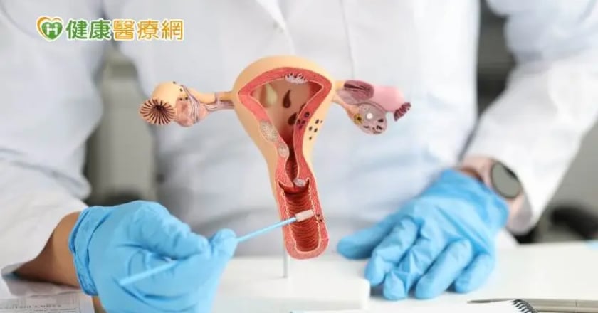子宮頸抹片檢查前要注意哪些？篩檢異常怎麼辦？　子宮頸癌篩檢一次看！