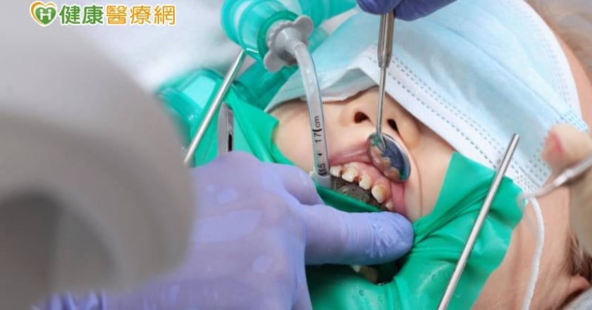 治療牙疾病,我適合用舒眠治療嗎? 專科醫直指「治療關鍵」