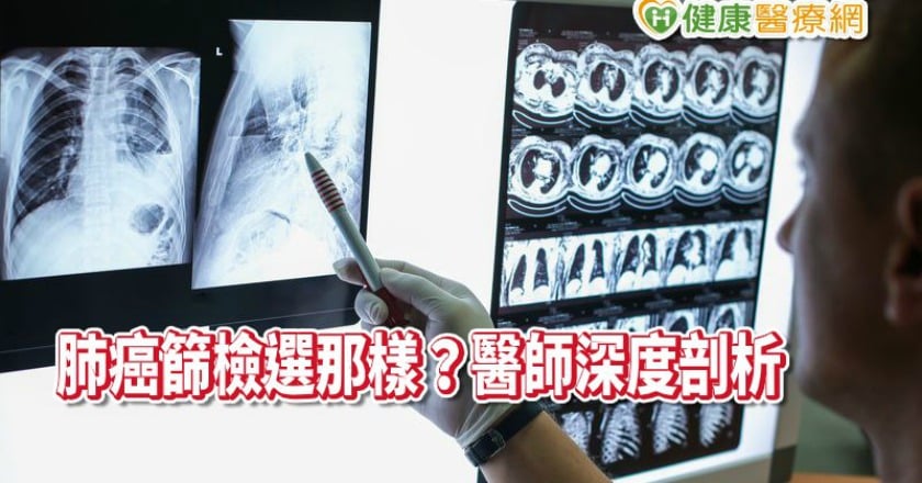 肺癌如何篩檢？該選那樣？　醫師深度剖析報你知
