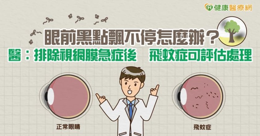 眼前黑點飄不停怎麼辦?醫:排除視網膜急症後 飛蚊症可評估處理