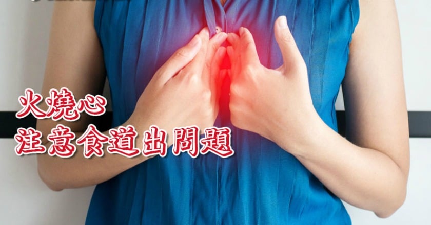 進食困難體重突減輕 竟是食道遲緩不能症?