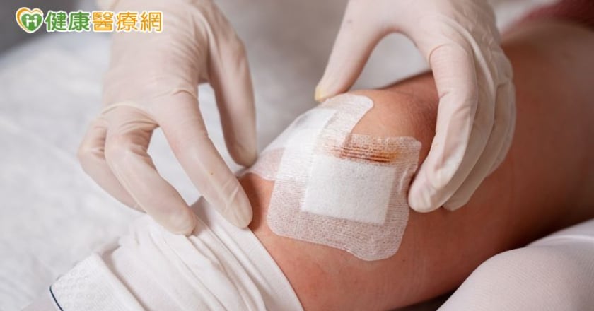 傷口照護學問多 醫師解析8種常見急、慢性傷口照護重點
