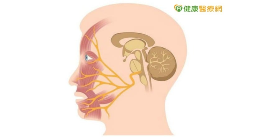 蘇貞昌「顏面神經麻痺」 醫:與「中風」差別一招分辨