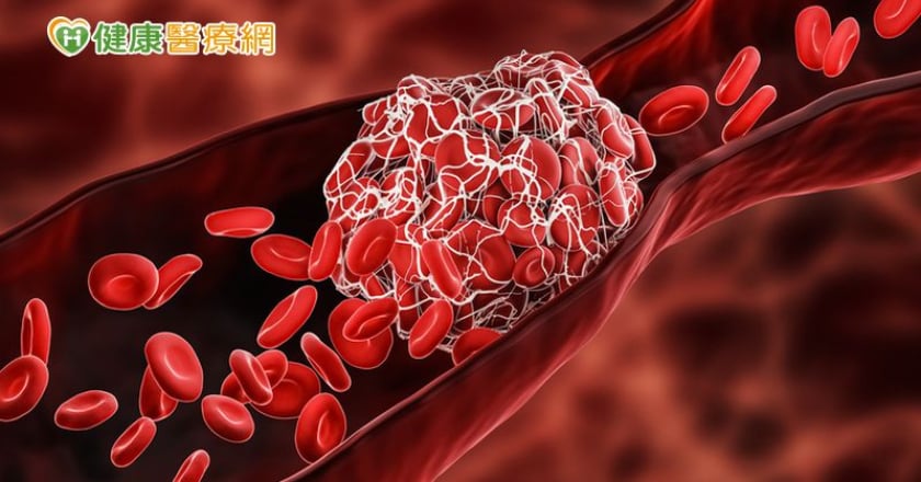 宅在家不運動氣血不通　手腳麻中醫籲活血多動
