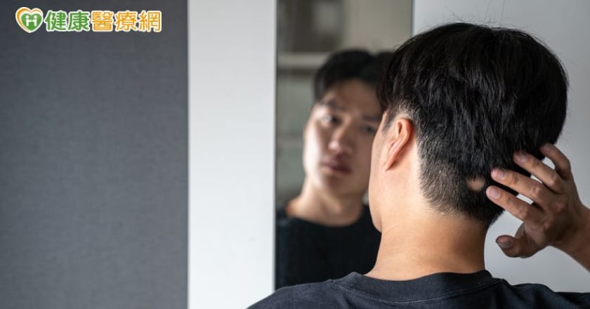 鬼剃頭是壓力引起?皮膚科醫師揭圓禿真相及治療對策