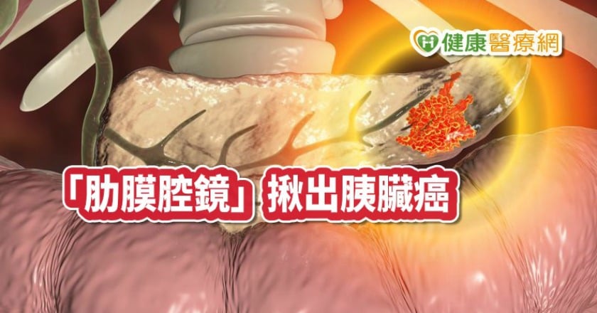 臉凹人消風! 咳喘、爆瘦竟是「癌王」上身