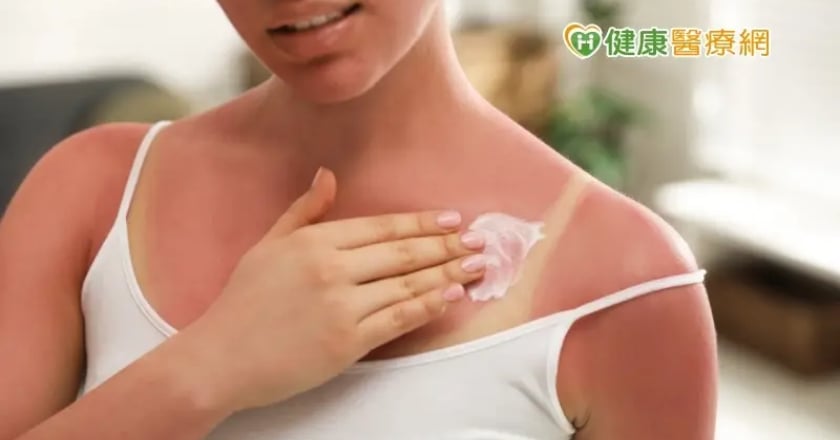 夏日危肌/長期日曬恐長斑、老化、罹皮膚癌! 擦多少防曬才夠力?