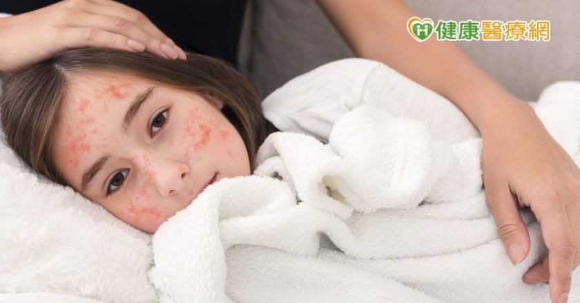 長幼同患病 一家雙頭燒 疫情降溫！預防水痘、皮蛇等高傳染疾病不能等