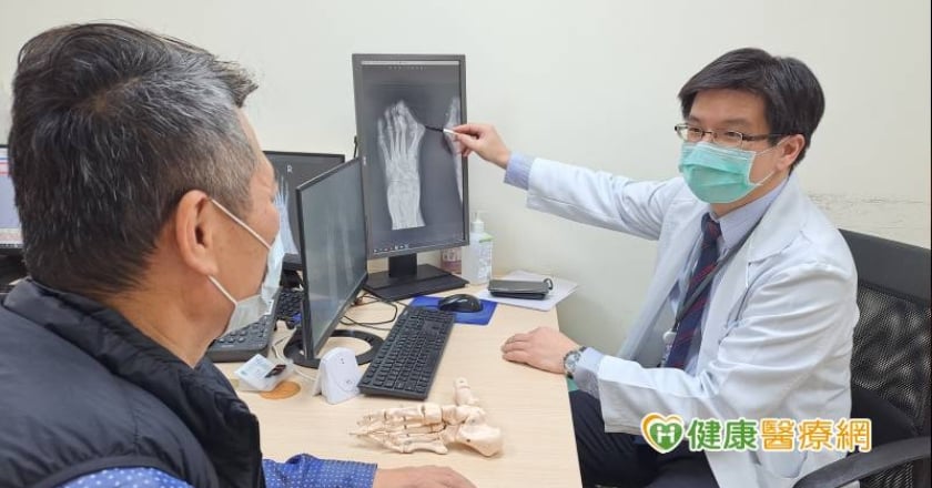 拇趾外翻又痛又醜長達10年 手術治療後登山健步如飛