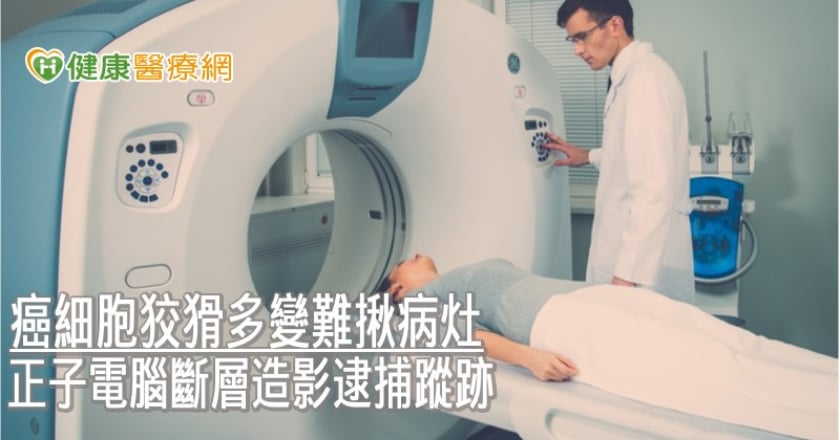 癌細胞狡猾多變難揪病灶 正子電腦斷層造影逮捕蹤跡