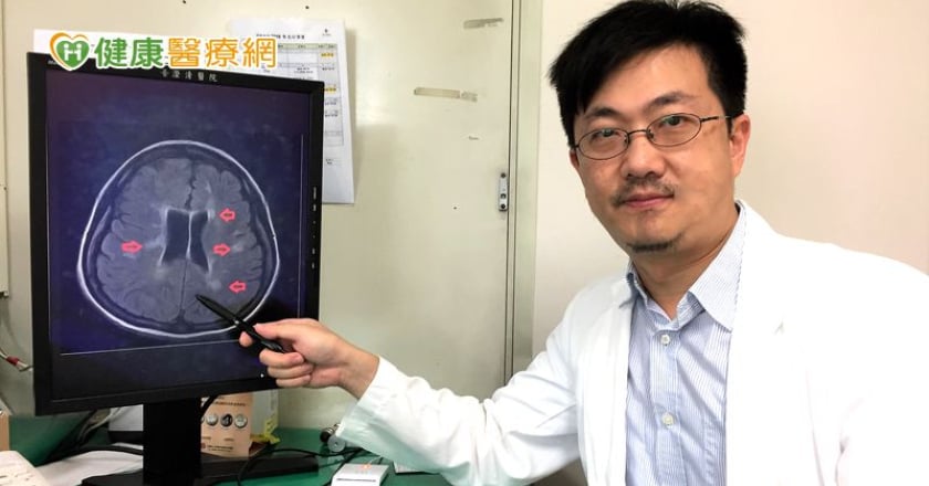 視力模糊、無力恐多發性硬化症？　健保藥物降5成復發率