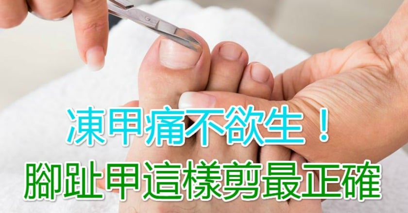 凍甲痛不欲生！　腳趾甲這樣剪最正確