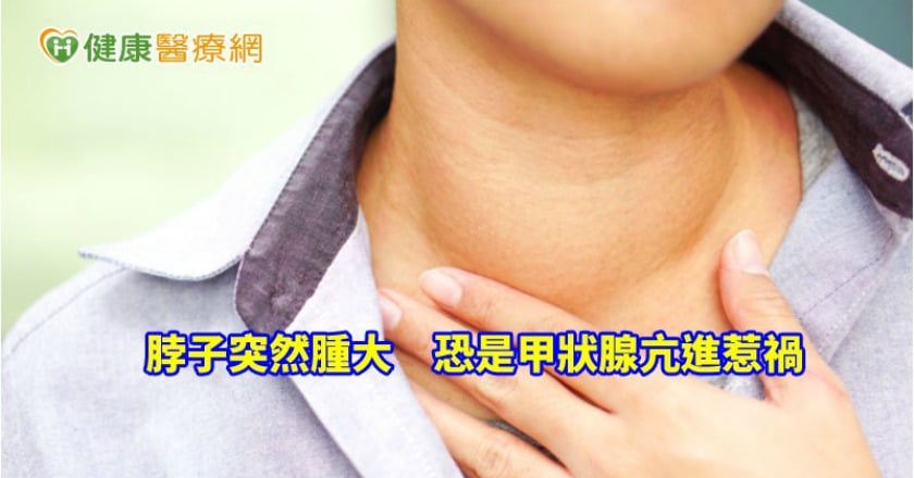 脖子突然腫大 恐是甲狀腺亢進惹禍