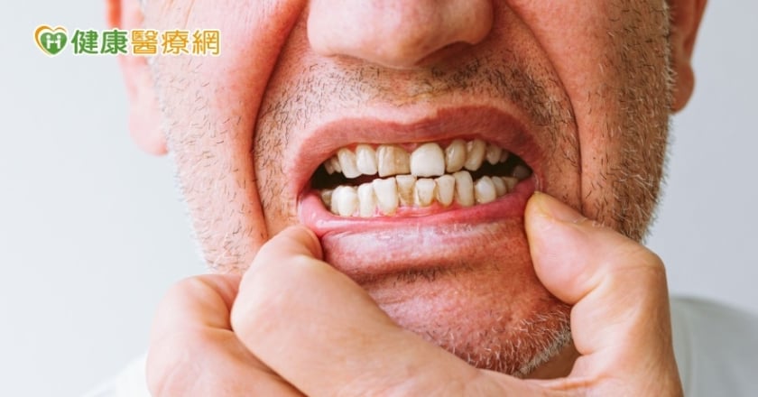 他嚴重牙周病戴活動假牙食物咬不爛 「1招」解噴假牙、咀嚼卡卡困擾