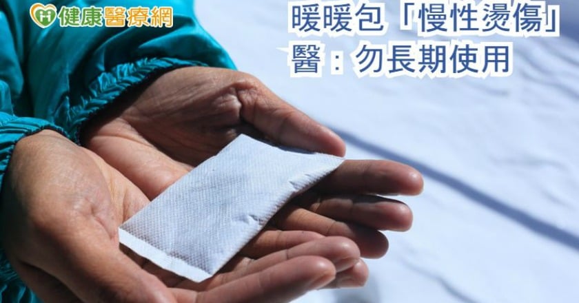 暖暖包「慢性燙傷」 醫:勿長期使用