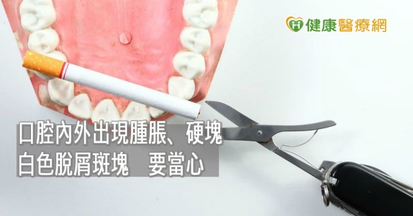 每年近4000人出現癌前病變！　口腔癌都會有這些特徵