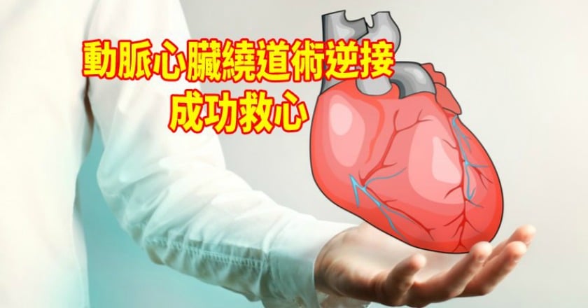 心血管嚴重阻塞 心臟繞道「逆接」術成功救心