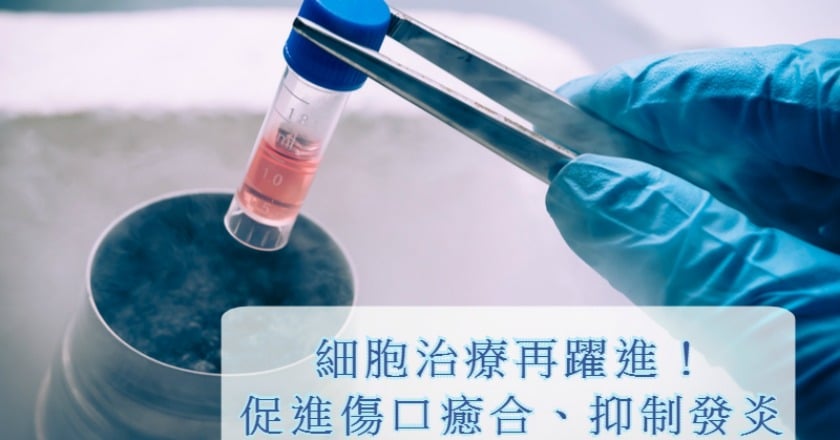 自體脂肪幹細胞新應用　加惠慢性、困難傷口族群