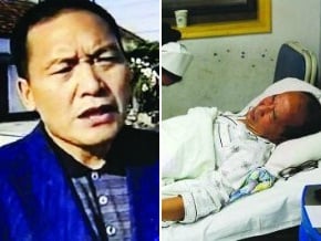 副局長當街打下屬致粉碎性骨折