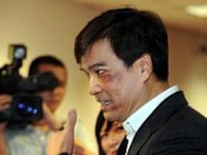跑攤跌倒 黃義交臉撞傷瘀青