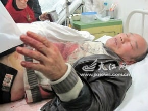 曾患精神疾病  男子藏半把剪刀捅人  