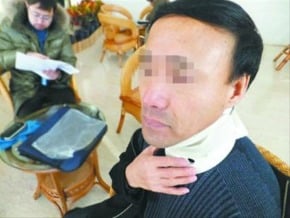 值班醫生遭患者家屬打成重傷
