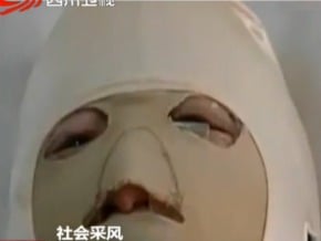 長期求愛未果 將少女火燒毀容