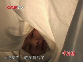 醉漢揮刀砍掉女孩左耳